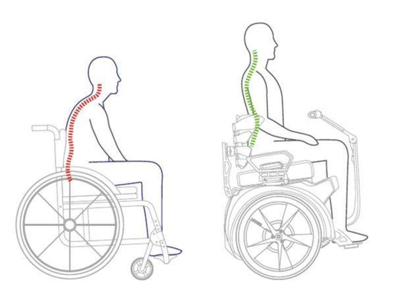 Illustration: hopsjunken hållning i manuell rullstol jämfört med upprätt hållning på en självbalanserande elrullstol